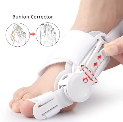 OrthoAlign™ Clinical Bunion Relief System