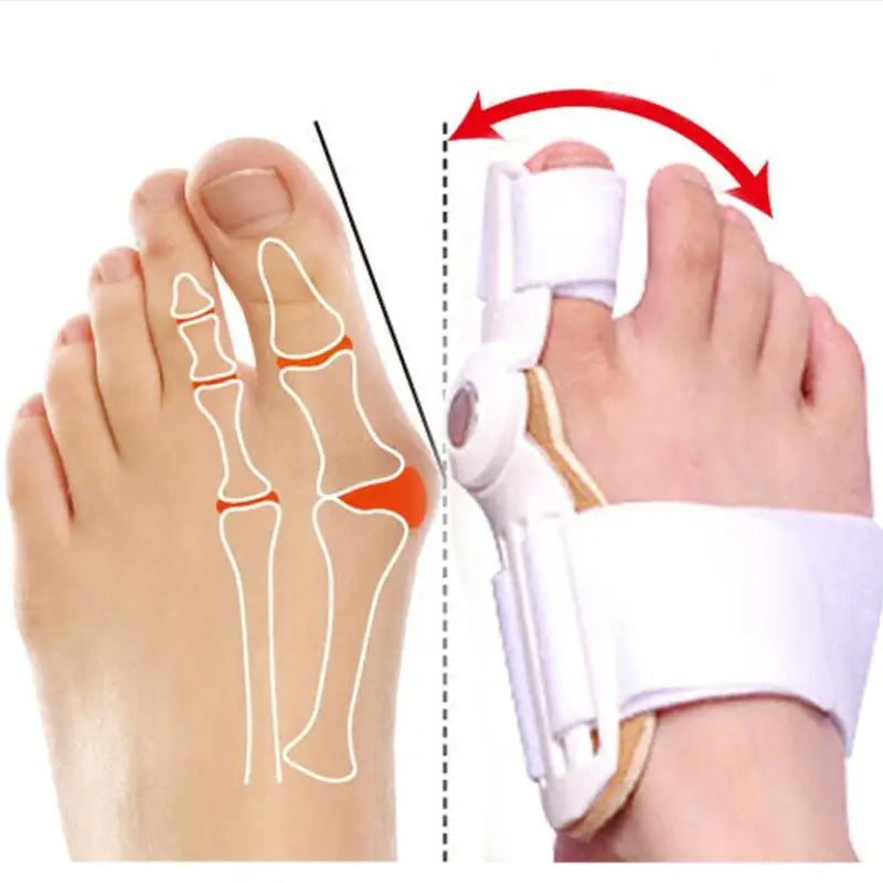 2 Pcs Adjustable Bunion Corrector for Big Toe Relief