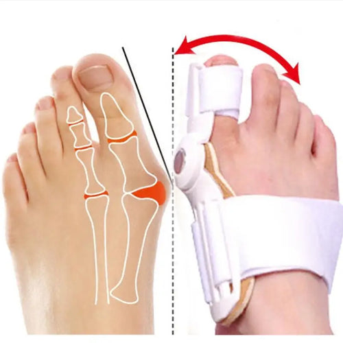 2 Pcs Adjustable Bunion Corrector for Big Toe Relief